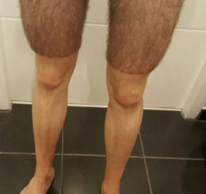 Hair Removal Aka Manscaping Better Than The Hand